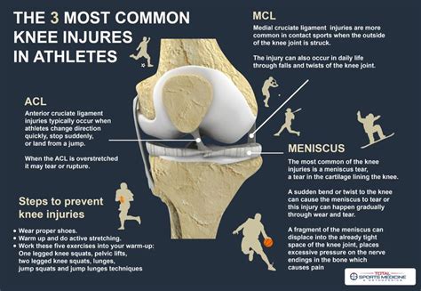 The 3 most common knee injuries in athletes | Cruciate ligament ...