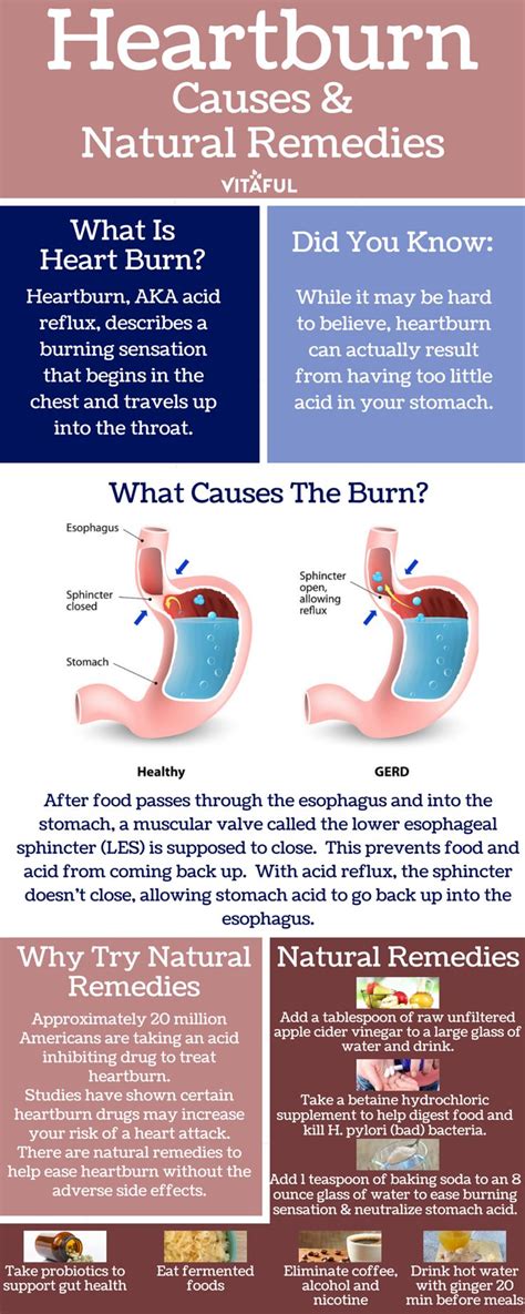 24 best Acid Reflux ...Heartburn images on Pinterest | Acid reflux ...