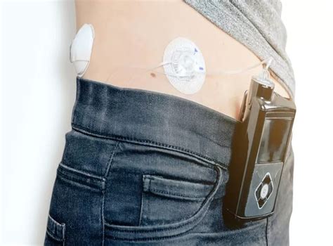 Diabetes breakthrough as life-changing artificial pancreas given NHS ...