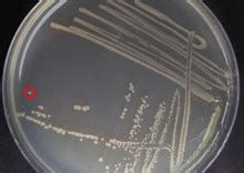 Bacterial Streak Plate