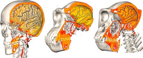 Evidence for independent brain and neurocranial reorganization during ...