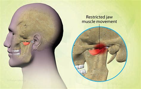 Health Condition : Symptoms, Causes, Treatment and More