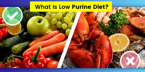 What is Low-Purine Diet? Know Which Foods To Add and Avoid | Onlymyhealth