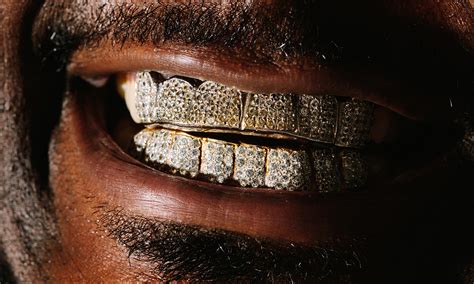 Aka Rapper Gold Teeth