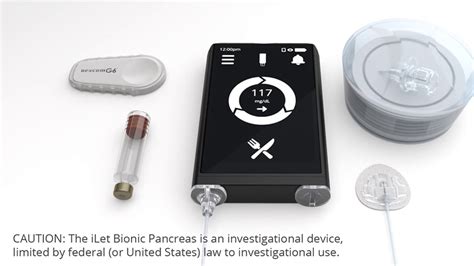 “Bionic Pancreas” Improves Blood Sugar Control in Type 1 Diabetics - UT Southwestern Medical Center