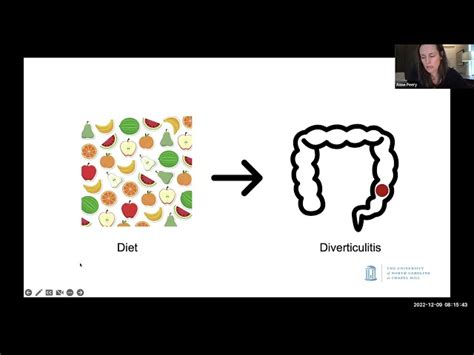 Gastroenterology - Medicine | Icahn School of Medicine