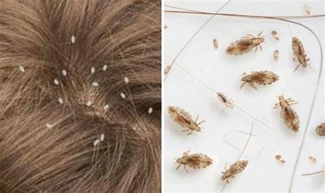 Warning over mutant head lice that are IMMUNE to lotions | UK | News ...