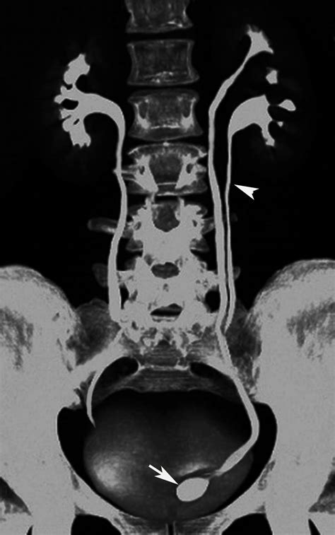 Radiodiagnosis - Imaging is Amazing-Interesting cases: Duplex ...