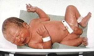 BBC News | HEALTH | Routine circumcision ruled out