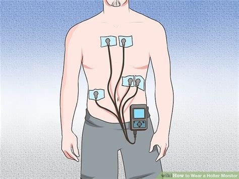 How to Wear a Holter Monitor: 12 Steps (with Pictures) - wikiHow