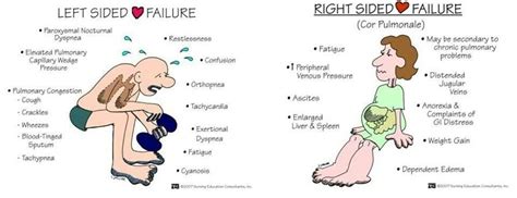 Heart Failure Diagram | Quizlet