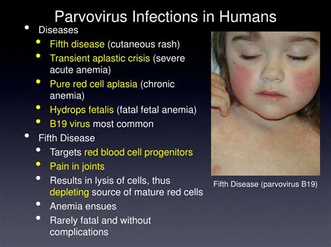 PPT - Parvoviruses PowerPoint Presentation, free download - ID:3279608