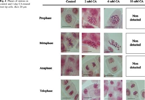 Stages Of Mitosis In Onion Root Tip