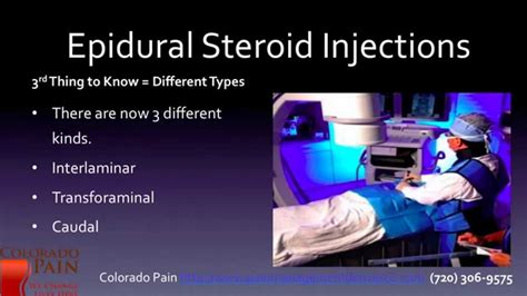 5 Things to Know About Epidural Steroid Injections - YouTube