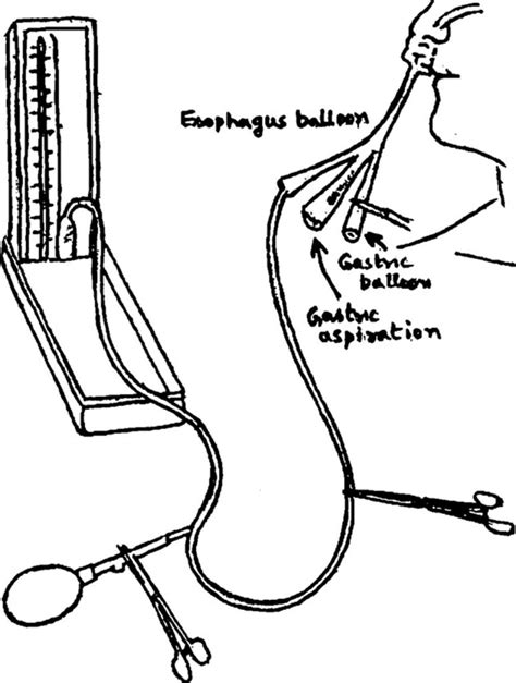 Sengstaken Blakemore tube uses, insertion & complications