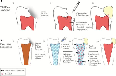 [DIAGRAM] Dental Pulp Diagram - MYDIAGRAM.ONLINE