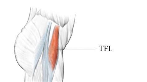 How to Fix Pain in the Tensor Fasciae Latae (TFL muscle)