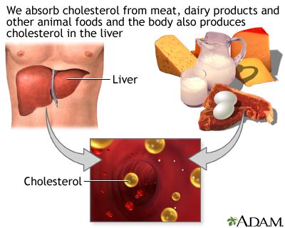 High blood cholesterol levels Information | Mount Sinai - New York