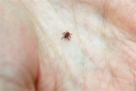 Did You Get Bit By A Lyme-Infested Tick? Here's What To Do | WBUR