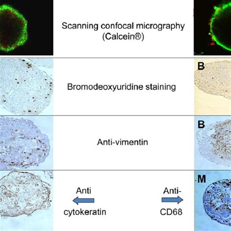 Spheroid staining. The upper three picture rows show consecutive... | Download Scientific Diagram