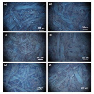 Evaluation of cell migration. Fluorescent microscopy images of MG-63 ...