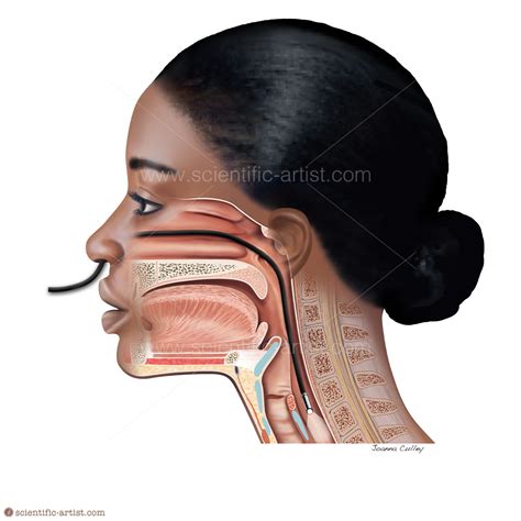 Trans-nasal endoscopy | | Scientific-Artist.com | Scientific Artist ...