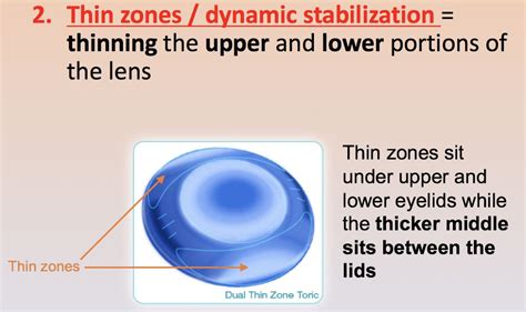 What Are Toric Contact Lenses?