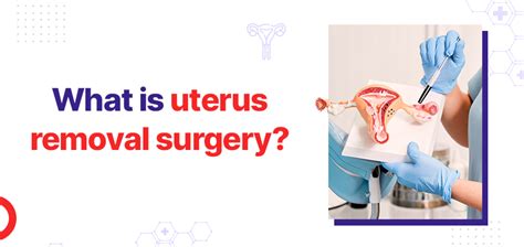 What Is Uterus Removal Surgery? - Gmoney.in