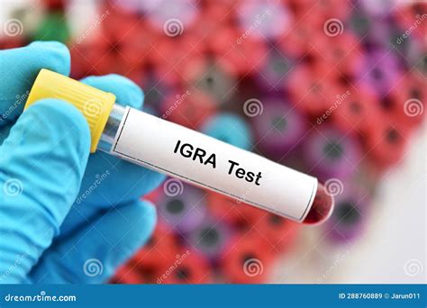 Interferon Gamma Release Assay or IGRA Test Stock Image - Image of tuberculosis, bacterium ...