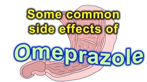 slsi.lk - how long for sulfatrim to work | Hope, is long term use of omeprazole harmful All