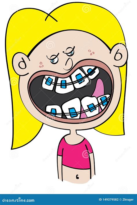 Funny White Girl with Dental Braces Cartoon Stock Vector - Illustration ...