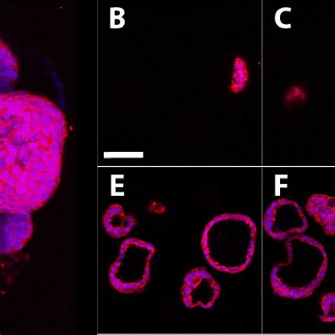 Morphology of MCF-7 cells grown in 2D and 3D cultures. MCF-7 human ...