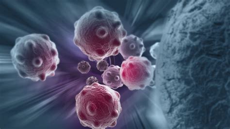 What Are Micrometastases and How Are They Treated?