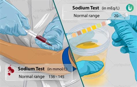 Sodium Test Kits