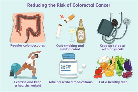 Polyps in Colon: Key Risks & Prevention Strategies - Lechatrougesf