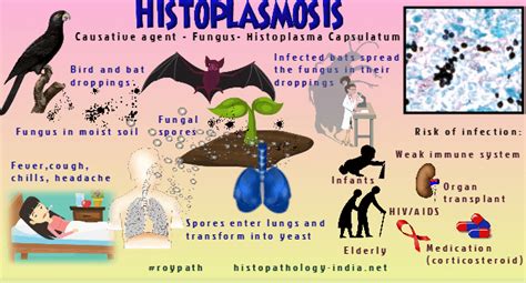 Pathology of Histoplasmosis - Dr Sampurna Roy MD