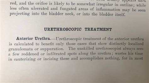 Chapter 21 (4): Urethroscopic Treatment - YouTube