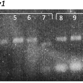 Colony PCR products generated with M13 LacZ specific primers ...