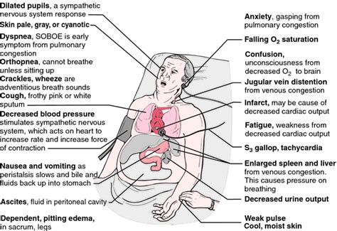 Congestive Heart Failure (CHF). Causes, symptoms, treatment Congestive ...