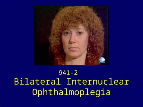 (PPT) Bilateral Internuclear Ophthalmoplegia - DOKUMEN.TIPS