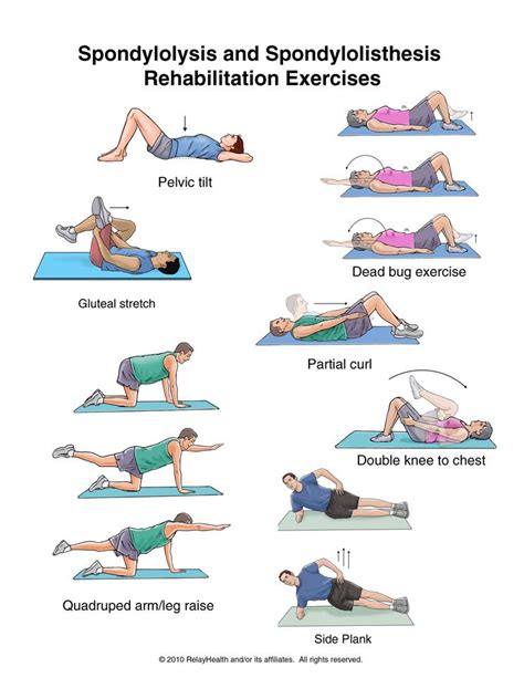 56 Best of Lumbar Spondylolisthesis Exercises - insectza