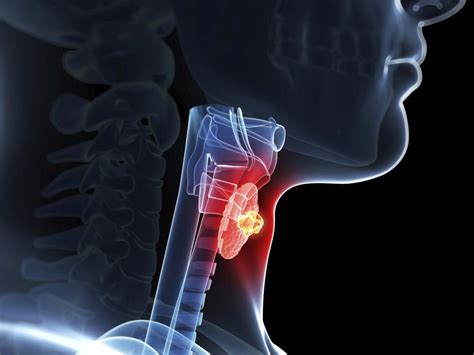 Thyroid Disease | Department of Medicine | Georgetown University