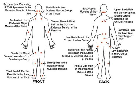 Trigger Point Chart – Jolt Therapy Tool