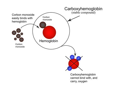 Carbon Monoxide Poisoning: Overview and Practice Questions