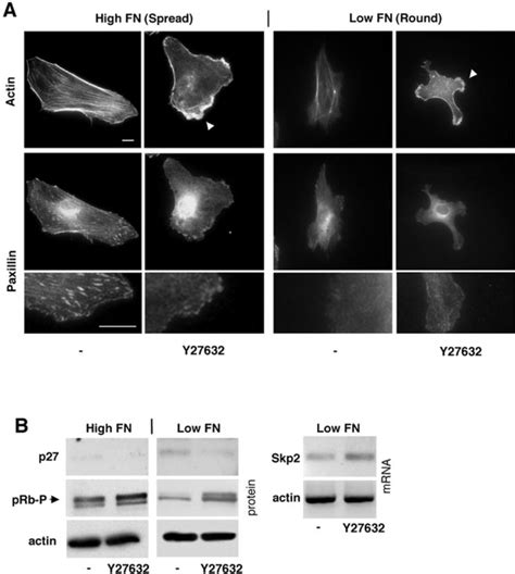 The ROCK inhibitor Y27632 alters cytoskeletal organization and induces ...