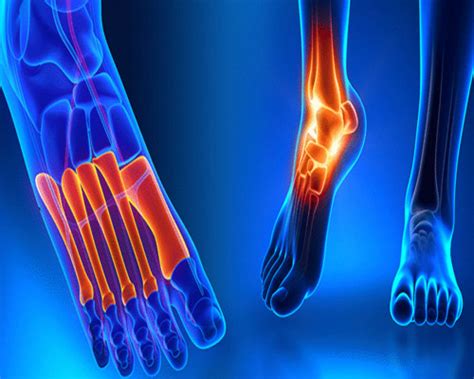 A Comprehensive Explanation On Different Orthopedic Implants Materials