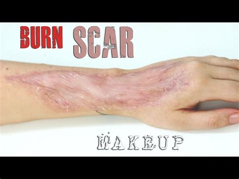 Easy Burn Scar Makeup | Saubhaya Makeup