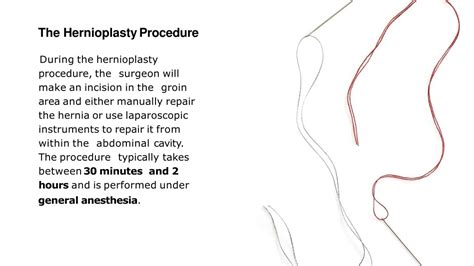 PPT - Inguinal Hernia Hernioplasty Surgery PowerPoint Presentation, free download - ID:12262945