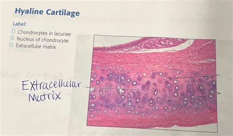 Solved Hyaline Cartilage Label: Chondrocytes in lacunae | Chegg.com