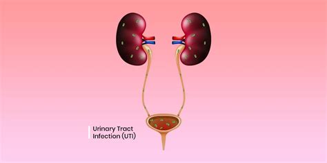 Urinary Tract Infection (UTI) Symptoms , Causes and Treatment